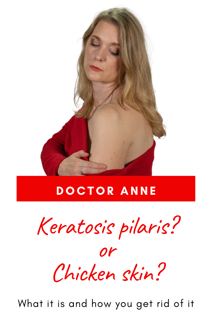 What is Keratosis pilaris and how do you get rid of it? The best products and mistakes you need to avoid.