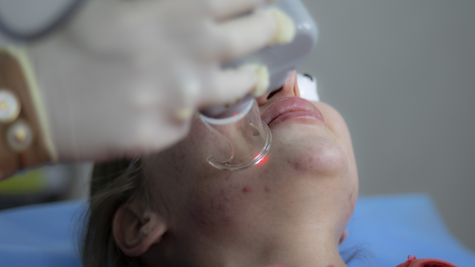 Redness is very common as side effect.