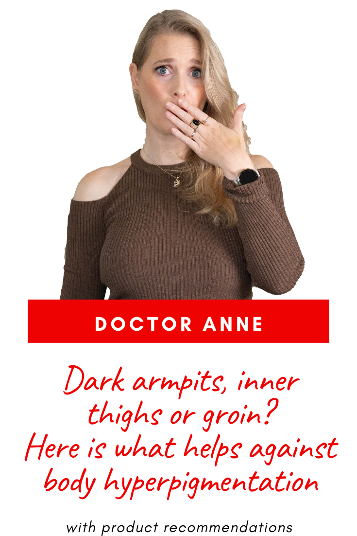 Everything you need to know about hyperpigmentation on the body